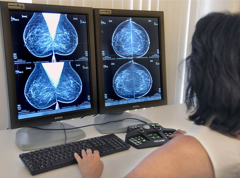 We kijken op de foto mee over de schouder van een vrouw die aan een bureau zit en twee toetsenborden bedient en hebben zicht op twee beeldschermen met daarop röntgenfoto's van borstonderzoek.